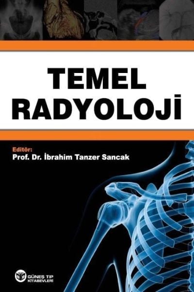 Temel Radyoloji