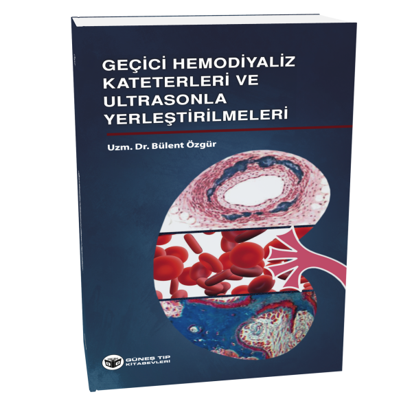 Geçici Hemodiyaliz Kateterleri ve Ultrasonla Yerleştirilmeleri