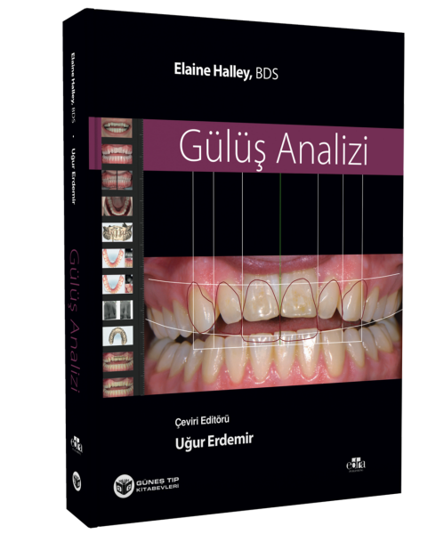 Gülüş Analizi