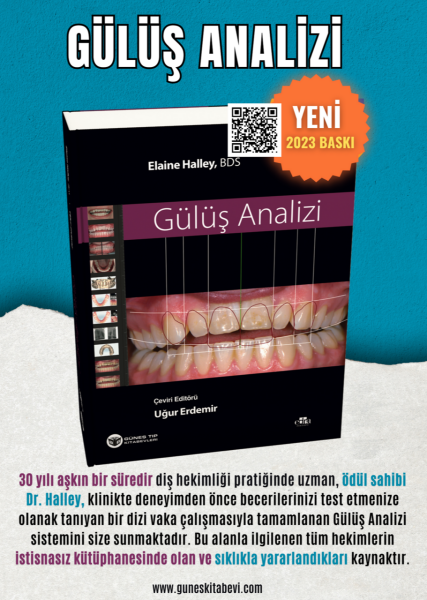 Gülüş Analizi