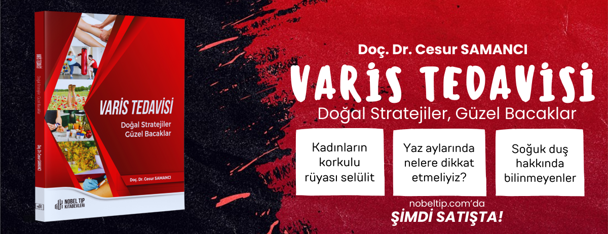 varis tedavisi