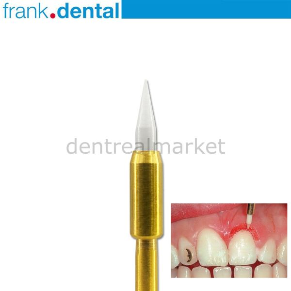 Gingiva Trimmer Yumuşak Doku Frezi - GT48L