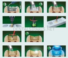 Gluma 2 Bond Refil