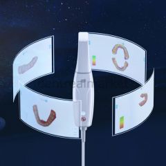 Woodpecker Smile Scan Intraoral - Ağız İçi Tarayıcı Cihazı