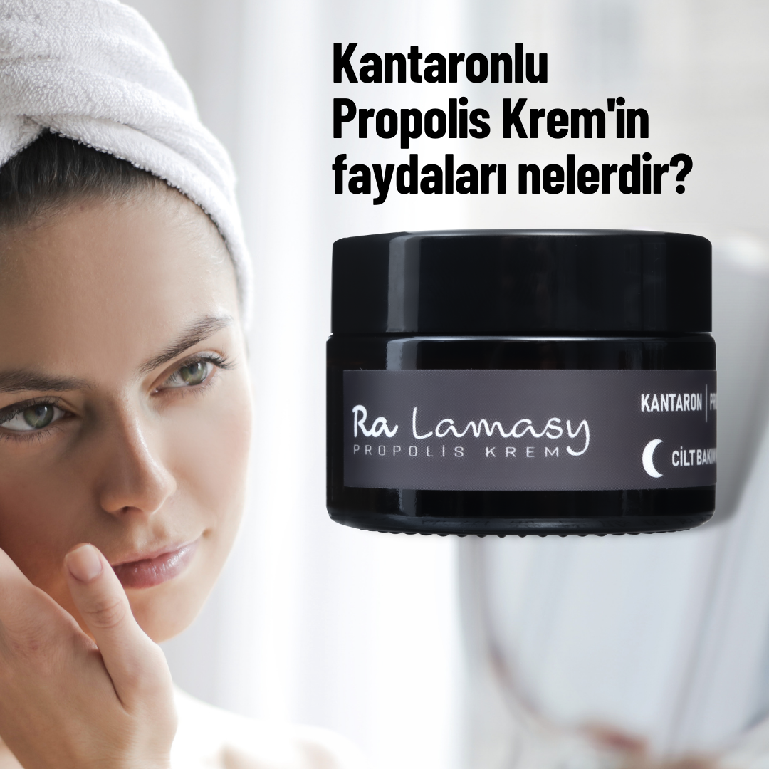 Kantaronlu Propolis Kremin faydaları nelerdir?