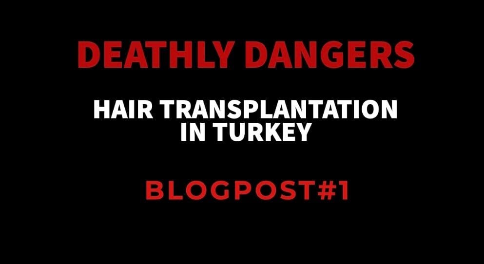 DANGERS WAITING FOR YOU IN HAIR TRANSPLANTATION IN TURKEY #1