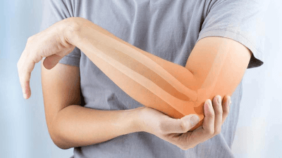 Osteoartrit (Kireçlenme) Nedir?