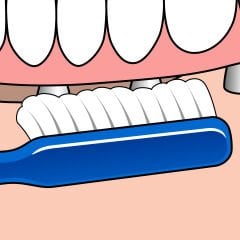 Özel Diş Fırçası Implant Orthodontic