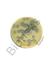 Baird-Parker Agar With Egg Yolk Tellurite (RTU) 120 petri x 90 mm