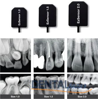 X-Visus Size 1 - İntraoral X-Ray Sensörü RVG