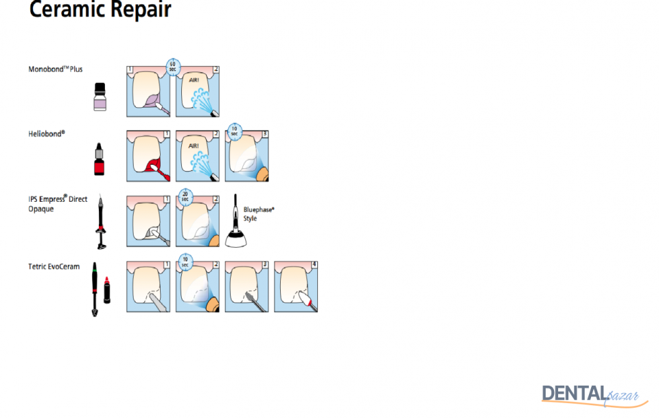 Ceramic Repair N System Kiti