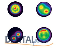 Smart Lite Focus Işınlı Dolgu Led Işık Cihazı