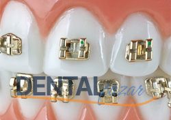 Forever Gold Metal Braket