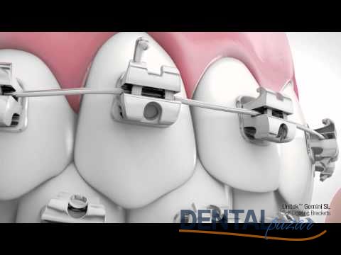 Gemini SL Kapaklı Metal Braket