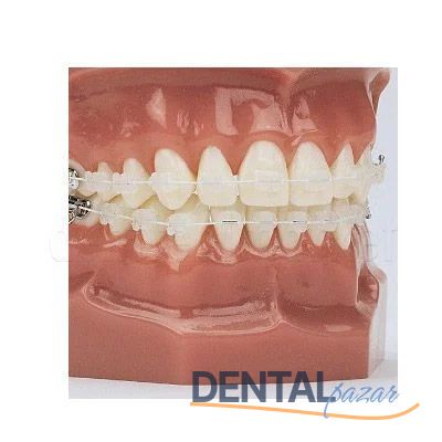 EverWhite Niti Cosmetic Orthodontik Wire Köşeli