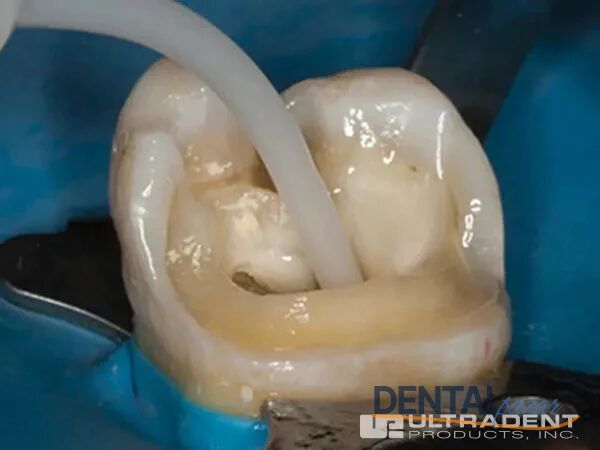 PermaFlo DC Rezin Siman Refil