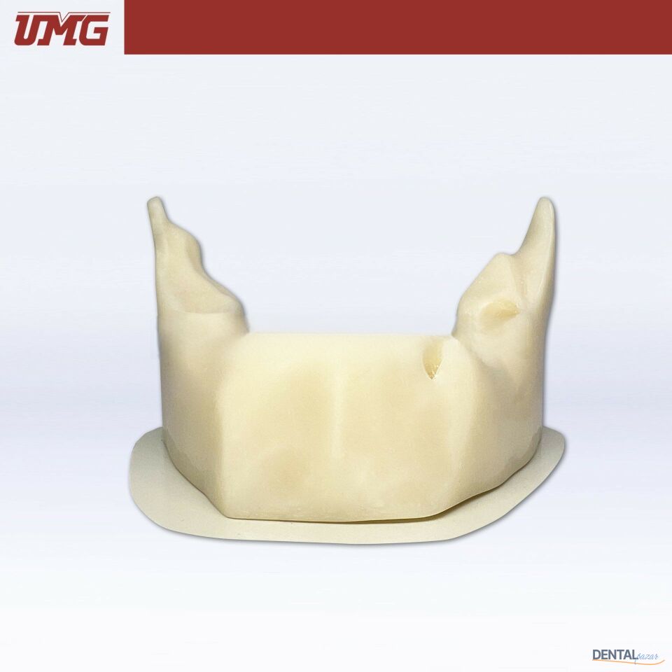 İmplant Yerleştirme Uygulaması için Anatomik Şekilli Kemik Mandibula
