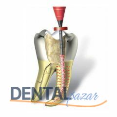 Protaper Wave One Guttacore - Sıcak Gütta