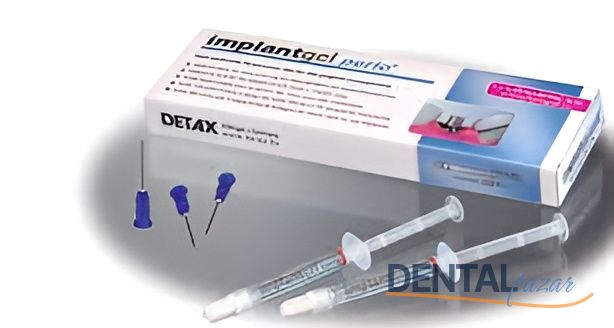 Implantgel Perio