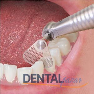 Os 30 Orthodonti Anguldurvası