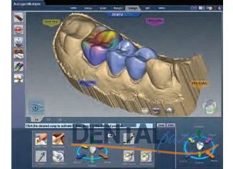 Tarama, Tasarım, Frezleme, CAD/CAM Cihazı