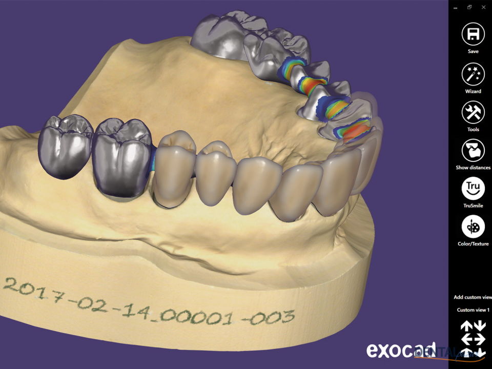 3D Dental Tasarım Programı - Implant Lab Bundle