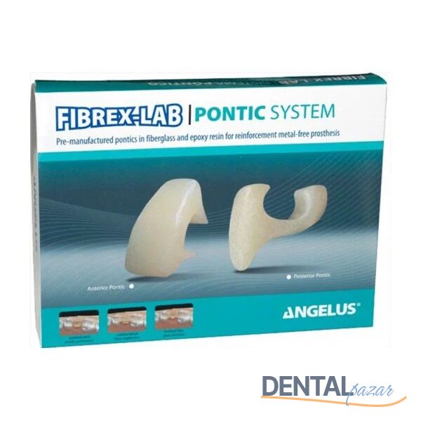 Fibrex-Lab Pontic System Kit
