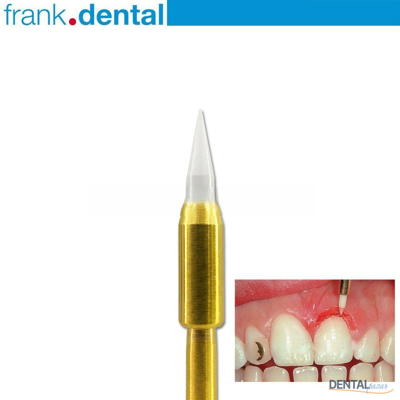 Gingiva Trimmer Yumuşak Doku Frezi - GT48L