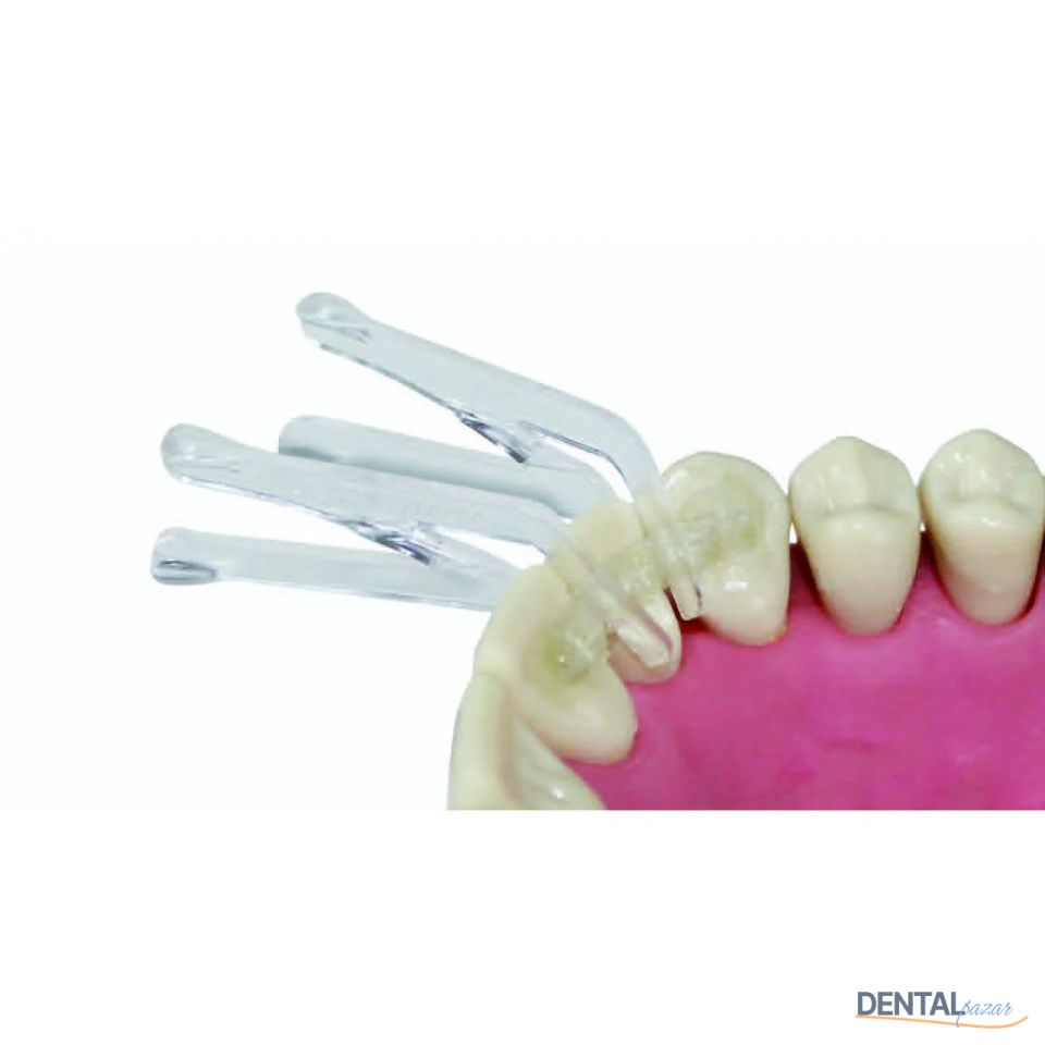 Fıber Splint Ortho Evolutıon