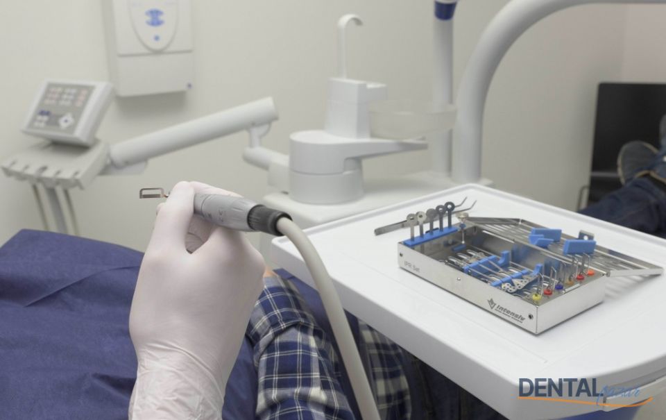 IPR InterProximal Reduction - Set