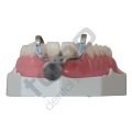 KSK Ivory Separator _ Anterior Diş Ayırıcı