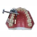 KSK Elliot Separator _ Posterior Diş Ayırıcı