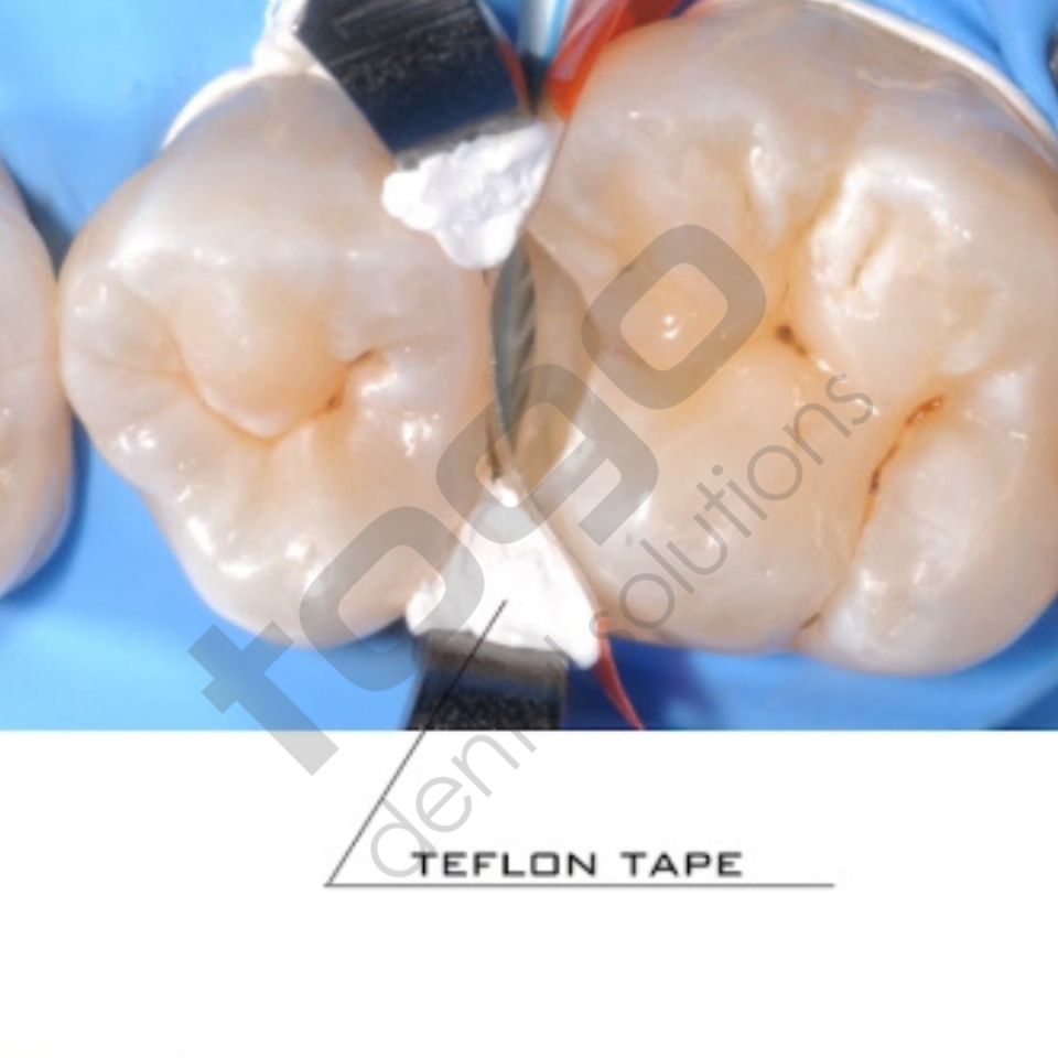 KSK Sectional Matrix (Böbrek Matris) Ring / Yüzük / Halka _ 2li Paket
