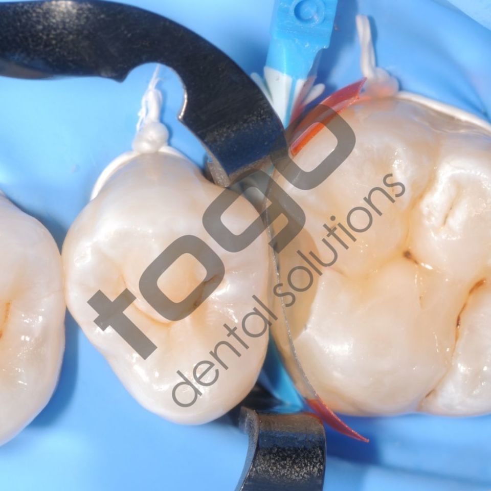 KSK Sectional Matrix (Böbrek Matris) Ring / Yüzük / Halka _ Set