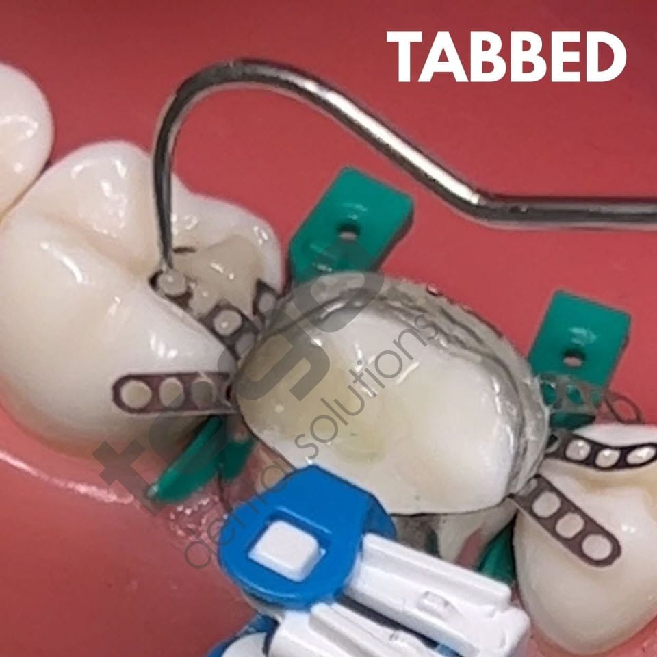 Rhondium QuickConnect Anatomy Band Refill _ Molar_Tabbed(Kulaklıklı) _ Large_45 Adet