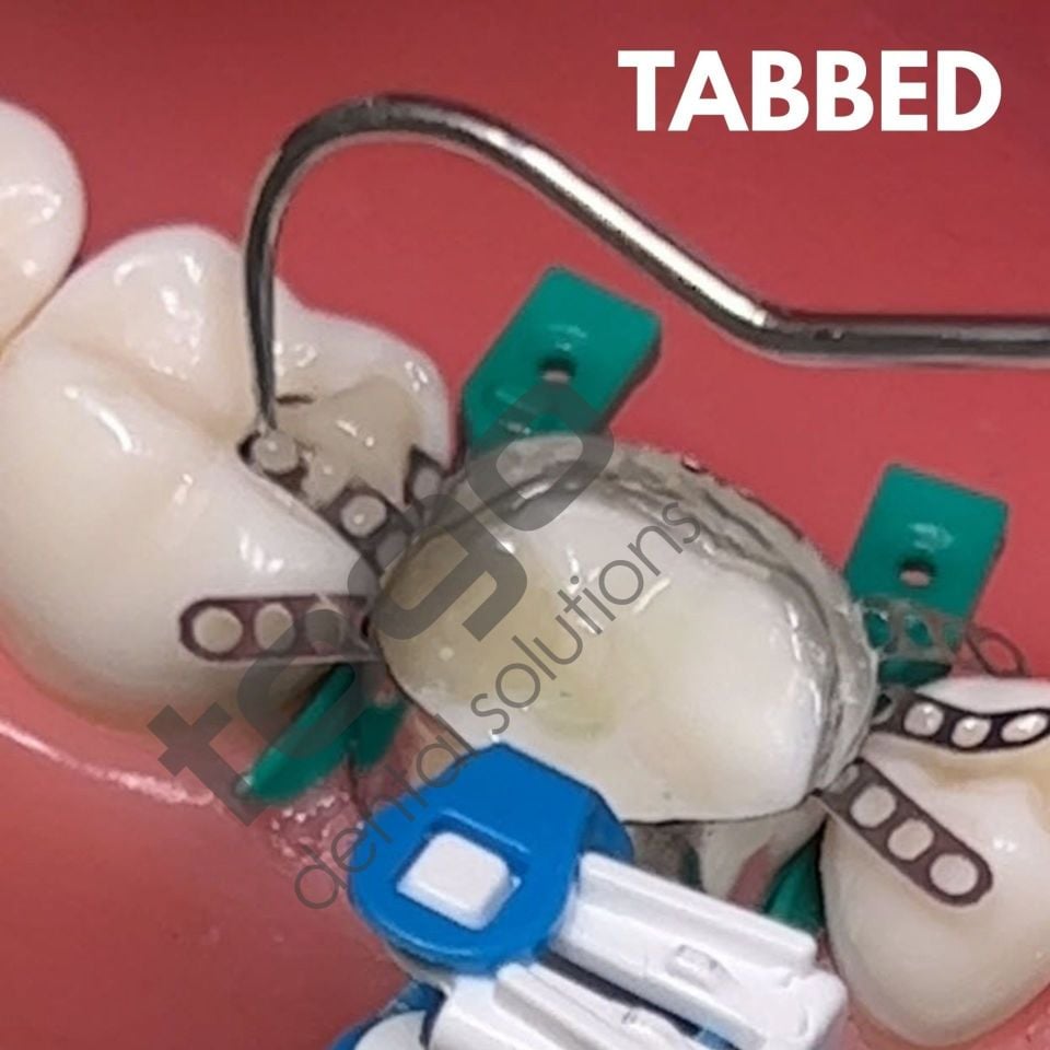 Rhondium QuickConnect Anatomy Band Refill _ Premolar_Tabbed(Kulaklıklı) _ Small_45 Adet