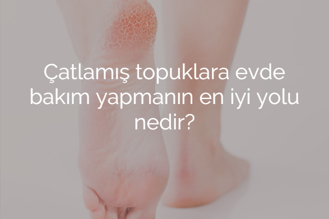 Çatlamış topuklara evde bakım yapmanın en iyi yolu nedir?