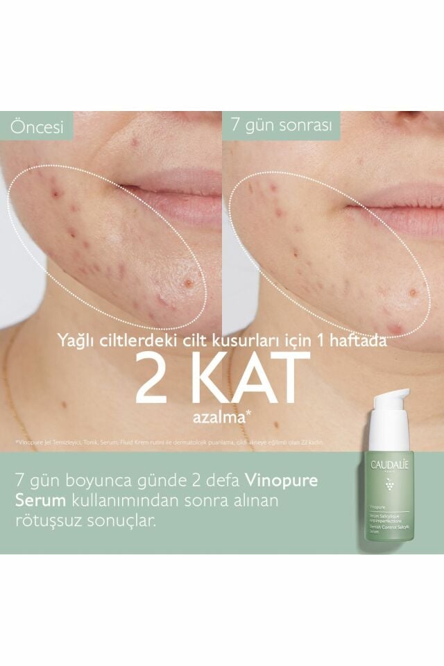 Caudalie Vinopure Salisilik Serum 30 ml