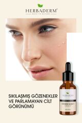 Herbaderm Superserum Gozenek Karsıtı 30 ml