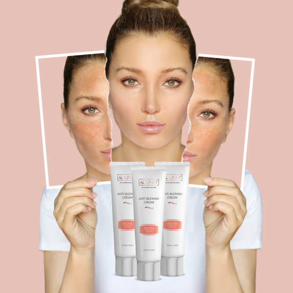 ACLIND® ANTI-BLEMISH CREAM / Leke Karşıtı Krem 30 ml