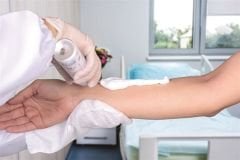 Actolind ® Foam Uygulama Eldiveni