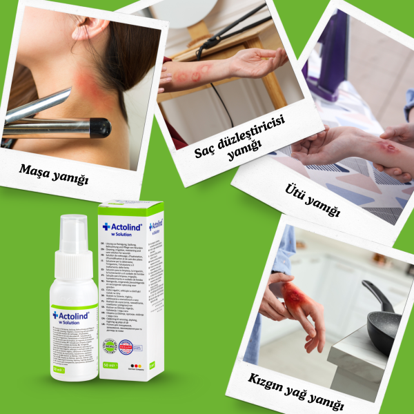 Actolind ® w Solution 50 ml | Yara İyileştirme Solüsyonu