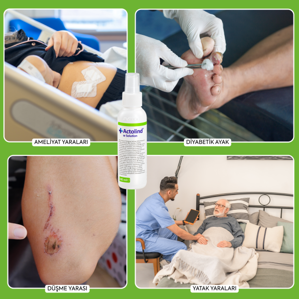 Actolind ® w Solution 100 ml | Yara İyileştirme Solüsyonu