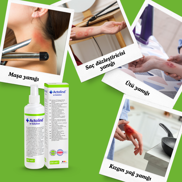 Actolind ® w Solution 250 ml | Yara İyileştirme Solüsyonu