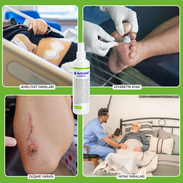Actolind ® w Solution 250 ml | Yara İyileştirme Solüsyonu