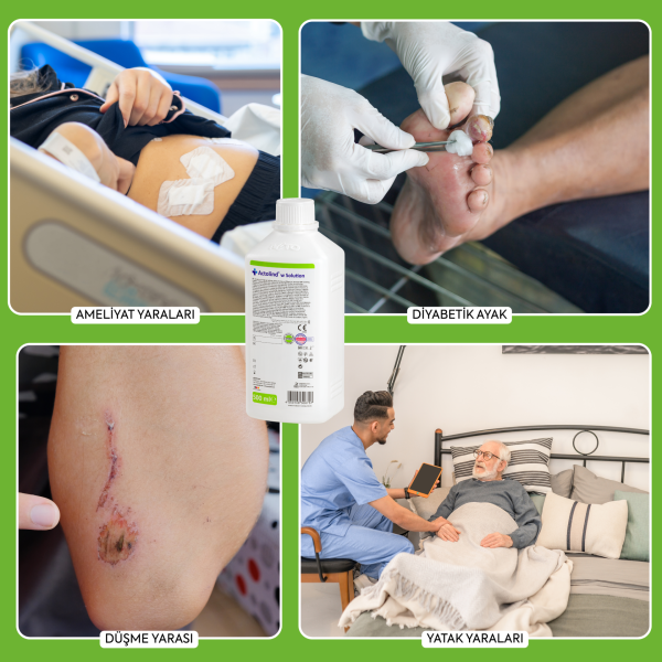 Actolind® w Solution 500 ml | Yara İyileştirme Solüsyonu