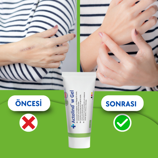 Actolind ® W Gel 10 ml | Yara İyileştirme Jeli