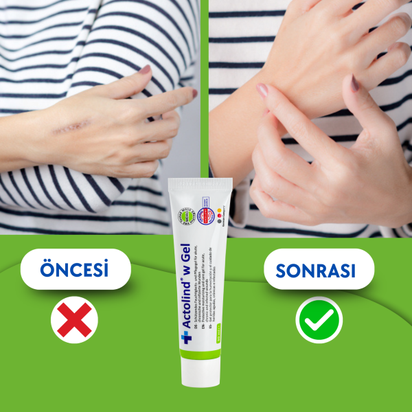 Actolind ® W Gel 30 ml | Yara İyileştirme Jeli