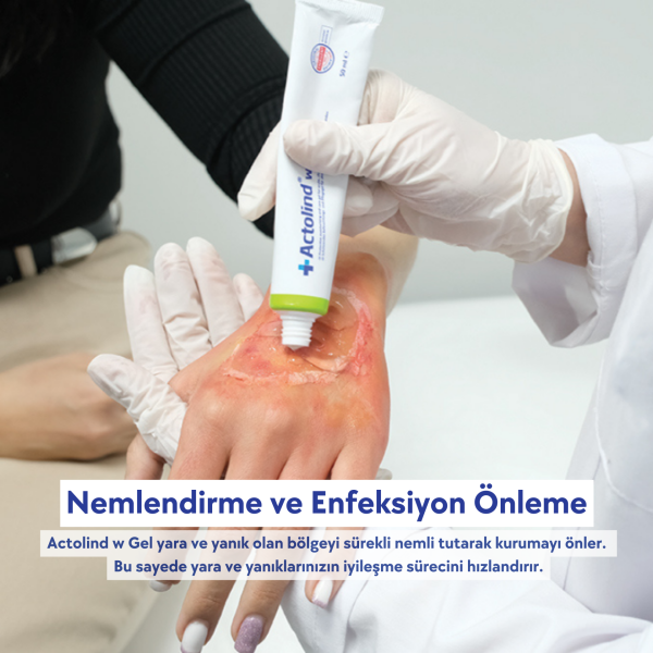 Actolind ® W Gel 30 ml | Yara İyileştirme Jeli