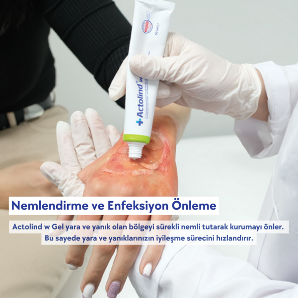 ACTOLIND® w GEL 50 ml [Yara İyileştirme Jeli]